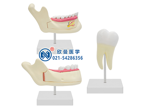 磨牙、乳牙、恒牙模型