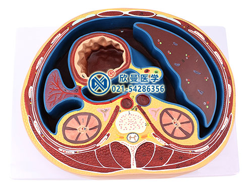 腹腔横断模型