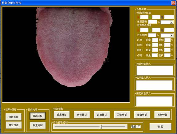 中医舌像采集分析仪分析与学习界面