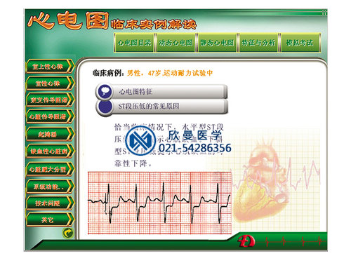 多媒体心电图教学与考核软件