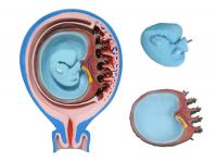 胎儿胎膜与子宫关系模型